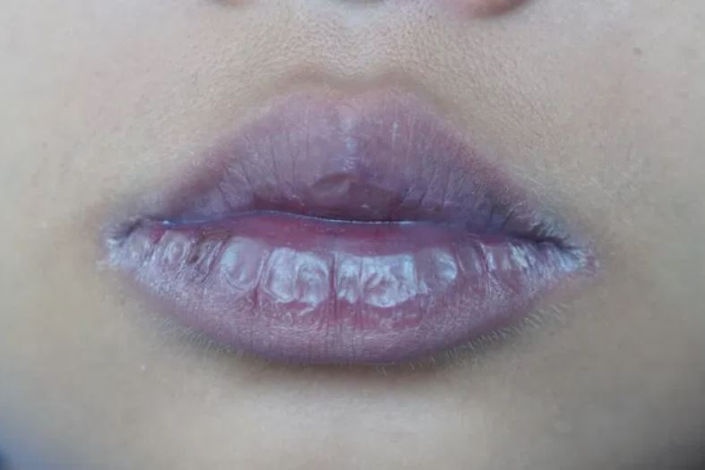 Lips