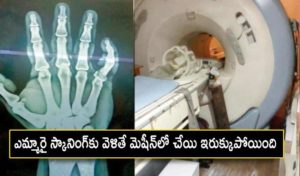 Mri Scanning