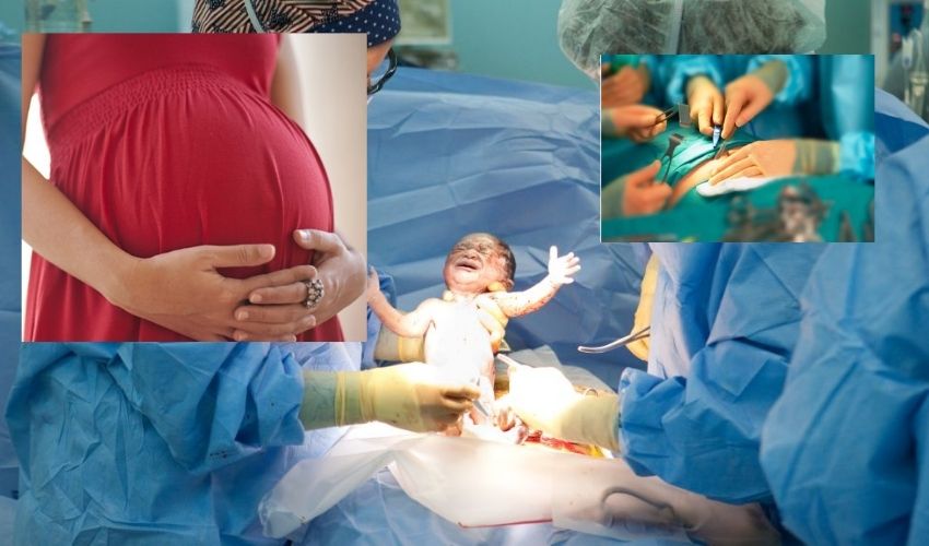 Midwifery in Govt Hospitals : నార్మల్ డెలివరీ కోసం ప్రభుత్వ ఆస్పత్రుల్లో గర్భిణిలకు వ్యాయామం | Midwifery in Telangana Govt Hospitals